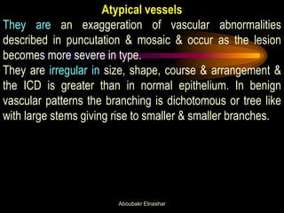 Atypical vessels
They are an exaggeration of vascular abnormalities
described in puncutation & mosaic & occur as the lesion
becomes more severe in type.
They are irregular in size, shape, course & arrangement &
the ICD is greater than in normal epithelium. In benign
vascular patterns the branching is dichotomous or tree like
with large stems giving rise to smaller & smaller branches.
Aboubakr Elnashar
 