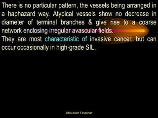 There is no particular pattern, the vessels being arranged in
a haphazard way. Atypical vessels show no decrease in
diameter of terminal branches & give rise to a coarse
network enclosing irregular avascular fields.
They are most characteristic of invasive cancer, but can
occur occasionally in high-grade SIL.
Aboubakr Elnashar
 