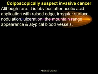 Colposcopically suspect invasive cancer
Although rare. It is obvious after acetic acid
application with raised edge, irregular surface,
nodulation, ulceration, the mountain range
appearance & atypical blood vessels.
Aboubakr Elnashar
 