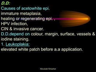 D.D:
Causes of acetowhite epi.
immature metaplasia,
healing or regenerating epi. ,
HPV infection,
CIN & invasive cancer.
D.D.depend on colour, margin, surface, vessels &
iodine staining.
1. Leukoplakia:
elevated white patch before a.a application.
Aboubakr Elnashar
 
