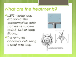 Colposcopy | PPT