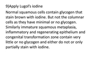 9)Apply Lugol’s iodine
Normal squamous cells contain glycogen that
stain brown with iodine. But not the columnar
cells as they have minimal or no glycogen.
Similarly immature squamous metaplasia,
inflammatory and regenerating epithelium and
congenital transformation zone contain very
little or no glycogen and either do not or only
partially stain with iodine.
 