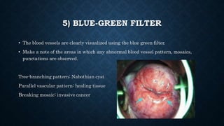 5) BLUE-GREEN FILTER
• The blood vessels are clearly visualized using the blue green filter.
• Make a note of the areas in which any abnormal blood vessel pattern, mosaics,
punctations are observed.
Tree-branching pattern: Nabothian cyst
Parallel vascular pattern: healing tissue
Breaking mosaic: invasive cancer
 