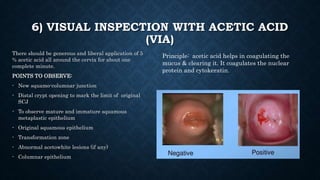 6) VISUAL INSPECTION WITH ACETIC ACID
(VIA)
There should be generous and liberal application of 5
% acetic acid all around the cervix for about one
complete minute.
POINTS TO OBSERVE:
- New squamo-columnar junction
- Distal crypt opening to mark the limit of original
SCJ
- To observe mature and immature squamous
metaplastic epithelium
- Original squamous epithelium
- Transformation zone
- Abnormal acetowhite lesions (if any)
- Columnar epithelium
Principle: acetic acid helps in coagulating the
mucus & clearing it. It coagulates the nuclear
protein and cytokeratin.
 