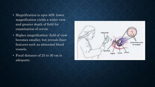 • Magnification is upto 40X; lower
magnification yields a wider view
and greater depth of field for
examination of cervix.
• Higher magnification: field of view
becomes smaller, but reveals finer
features such as abnormal blood
vessels.
• Focal distance of 25 to 30 cm is
adequate.
 