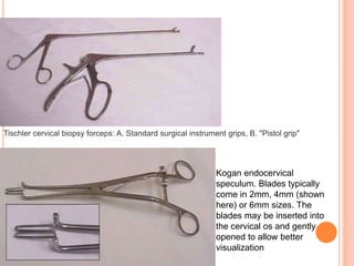 Tischler cervical biopsy forceps: A. Standard surgical instrument grips, B. "Pistol grip"
Kogan endocervical
speculum. Blades typically
come in 2mm, 4mm (shown
here) or 6mm sizes. The
blades may be inserted into
the cervical os and gently
opened to allow better
visualization
 