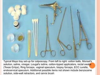 Typical Mayo tray set-up for colposcopy. From left to right: cotton balls, Monsel's
solution, saline, vinegar, Lougal's iodine, cotton-tipped applicators, rectal swabs
(Texas Q-tips), Ring forceps, vaginal speculum, biopsy forceps, ECC curette,
endocervical speculum. Additional possible items not shown include benzocaine
solution, side-wall retractors, and cervix brush
 