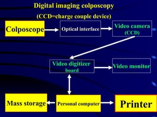 Colposcope Video camera
(CCD)
Optical interface
Video monitor
Video digitizer
board
Printer
Personal computer
Mass storage
Digital imaging colposcopy
(CCD=charge couple device)
 