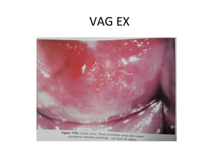 VAG EX

 