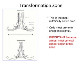 Transformation Zone
• This is the most
mitotically active area.
• Cells most prone to
oncogenic stimuli.
• IMPORTANT because
almost most cervical
cancer occur in this
zone

 