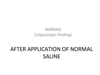 NORMAL
Colposcopic Findings

AFTER APPLICATION OF NORMAL
SALINE

 