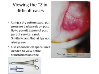 Viewing the TZ in
difficult cases
• Using a dry cotton swab, put
pressure backwards on post
lip to permit examn of post
part of cervical canal.
Similarly, ant. But lat lips not
always seen.
• Use endocervical speculum if
needed to view entire
transformation zone

 