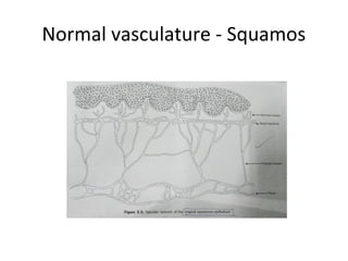 Normal vasculature - Squamos

 