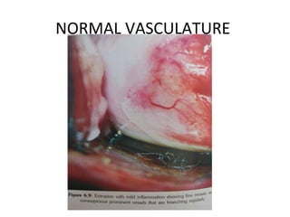 NORMAL VASCULATURE

 