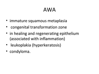 AWA
• immature squamous metaplasia
• congenital transformation zone
• in healing and regenerating epithelium
(associated with inflammation)
• leukoplakia (hyperkeratosis)
• condyloma.

 