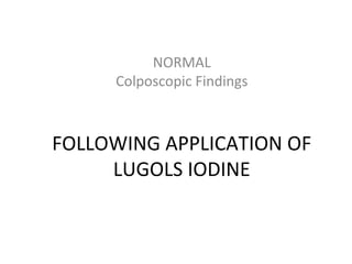 NORMAL
Colposcopic Findings

FOLLOWING APPLICATION OF
LUGOLS IODINE

 