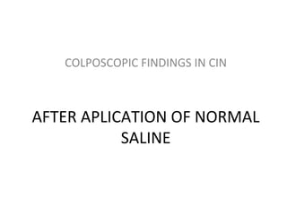 COLPOSCOPIC FINDINGS IN CIN

AFTER APLICATION OF NORMAL
SALINE

 
