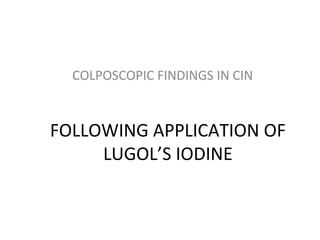 COLPOSCOPIC FINDINGS IN CIN

FOLLOWING APPLICATION OF
LUGOL’S IODINE

 