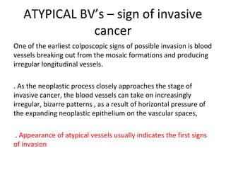 ATYPICAL BV’s – sign of invasive
cancer
One of the earliest colposcopic signs of possible invasion is blood
vessels breaking out from the mosaic formations and producing
irregular longitudinal vessels.
. As the neoplastic process closely approaches the stage of
invasive cancer, the blood vessels can take on increasingly
irregular, bizarre patterns , as a result of horizontal pressure of
the expanding neoplastic epithelium on the vascular spaces,
. Appearance of atypical vessels usually indicates the first signs
of invasion

 