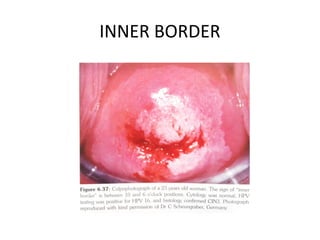 INNER BORDER

 