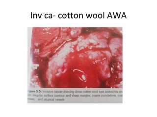 Inv ca- cotton wool AWA

 