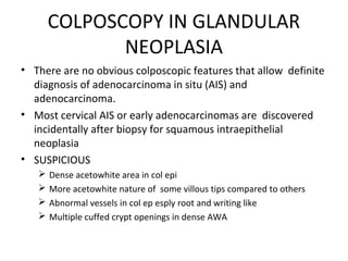 COLPOSCOPY IN GLANDULAR
NEOPLASIA
• There are no obvious colposcopic features that allow definite
diagnosis of adenocarcinoma in situ (AIS) and
adenocarcinoma.
• Most cervical AIS or early adenocarcinomas are discovered
incidentally after biopsy for squamous intraepithelial
neoplasia
• SUSPICIOUS





Dense acetowhite area in col epi
More acetowhite nature of some villous tips compared to others
Abnormal vessels in col ep esply root and writing like
Multiple cuffed crypt openings in dense AWA

 