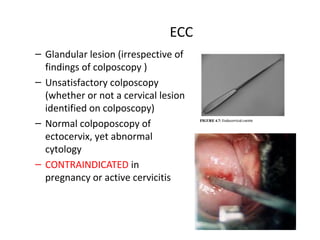 ECC
– Glandular lesion (irrespective of
findings of colposcopy )
– Unsatisfactory colposcopy
(whether or not a cervical lesion
identified on colposcopy)
– Normal colpoposcopy of
ectocervix, yet abnormal
cytology
– CONTRAINDICATED in
pregnancy or active cervicitis

 