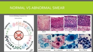 NORMAL VS ABNORMAL SMEAR
 