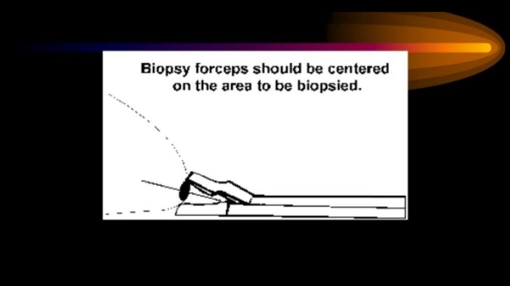 Colposcopy technique