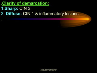 .Clarity of demarcation:
1.Sharp: CIN 3
2. Diffuse: CIN 1 & inflammatory lesions
.
Aboubakr Elnashar
 