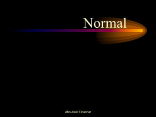 Normal
Aboubakr Elnashar
 