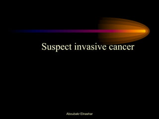 Suspect invasive cancer
Aboubakr Elnashar
 