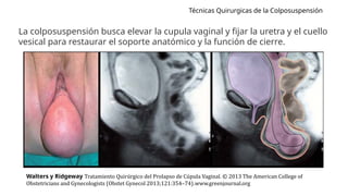 Técnicas Quirúrgicas Avanzadas en Histerectomía y Colposuspensión para ...