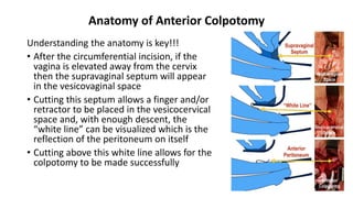 Vaginal Hysterectomy Anterior and Posterior Colpotomies | PPTX