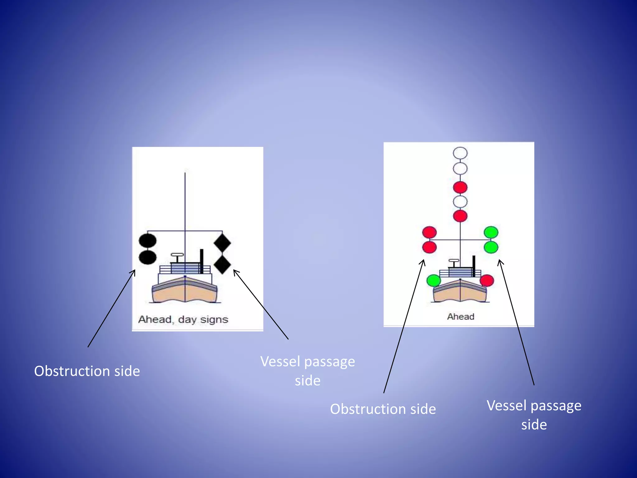 Obstruction side
Vessel passage
side
Obstruction side Vessel passage
side
 