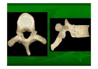 Columna Vertebral