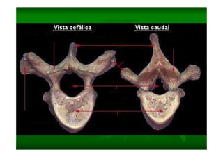 Columna Vertebral