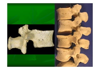 Columna Vertebral