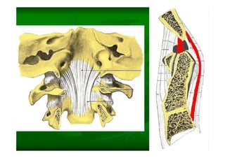 Columna Vertebral