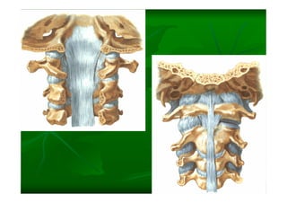 Columna Vertebral