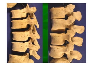 Columna Vertebral