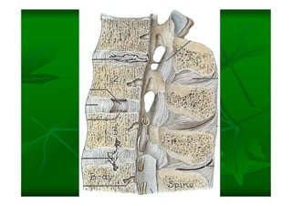 Columna Vertebral