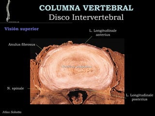 COLUMNA VERTEBRAL
Disco IntervertebralDisco Intervertebral
Atlas Sobotta
Visión superior L. Longitudinale
anterius
L. Longitudinale
posterius
Nucleus pulposusNucleus pulposus
Anulus fibrosus
N. spinale
 
