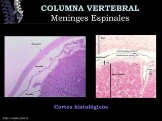 http://www.efoa.br
COLUMNA VERTEBRAL
Meninges EspinalesMeninges Espinales
Cortes histológicos
 