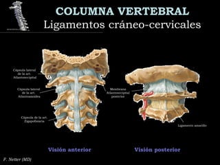 COLUMNA VERTEBRAL
Ligamentos cráneo-cervicalesLigamentos cráneo-cervicales
F. Netter (MD)
Visión anterior Visión posterior
Cápsula lateral
de la art.
Atlantoaxoidea
Cápsula de la art.
Zigapofisiaria
Membrana
Atlantooccipital
posterior
Cápsula lateral
de la art.
Atlantooccipital
Ligamento amarillo
 