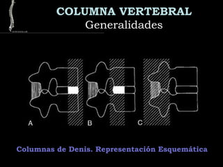 COLUMNA VERTEBRAL
GeneralidadesGeneralidades
Columnas de Denis. Representación Esquemática
 