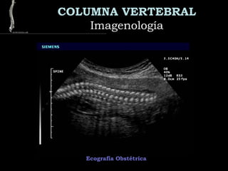 COLUMNA VERTEBRAL
ImagenologíaImagenología
Ecografía Obstétrica
 