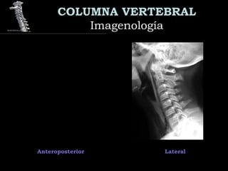COLUMNA VERTEBRAL
ImagenologíaImagenología
Anteroposterior Lateral
 