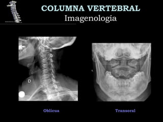 COLUMNA VERTEBRAL
ImagenologíaImagenología
TransoralOblícua
 