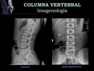 COLUMNA VERTEBRAL
ImagenologíaImagenología
Lateral Anteroposterior
 